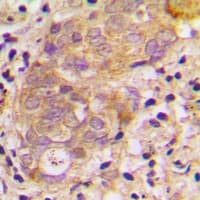 TGFB3 / TGF Beta3 Antibody (Internal)