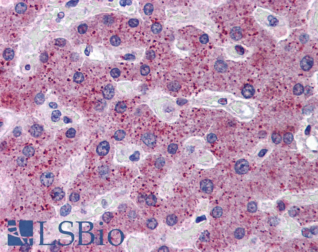 TMPRSS6 Antibody (aa71-120)