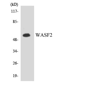 IHC-plus™ Polyclonal Rabbit anti-Human WASF2 / SCAR2 Antibody (aa125-174, IHC, WB)