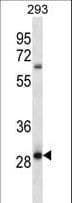 Polyclonal Rabbit anti-Human MRAP2 Antibody (aa58-86, IHC, WB)