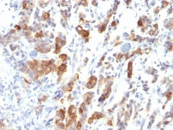 MUC5AC Antibody (clone MUC5AC/917)