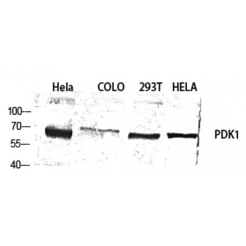 Polyclonal Rabbit anti-Human PDPK1 / PDK1 Antibody (180-260 aa, IHC, WB)