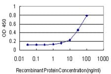 PathPlus™ Monoclonal Mouse anti-Human FGF1 / Acidic FGF Antibody (clone 1F9, IHC, IF, WB)