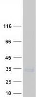Human SEC22L2 / SEC22A Protein (Recombinant Myc-DDK (Flag))
