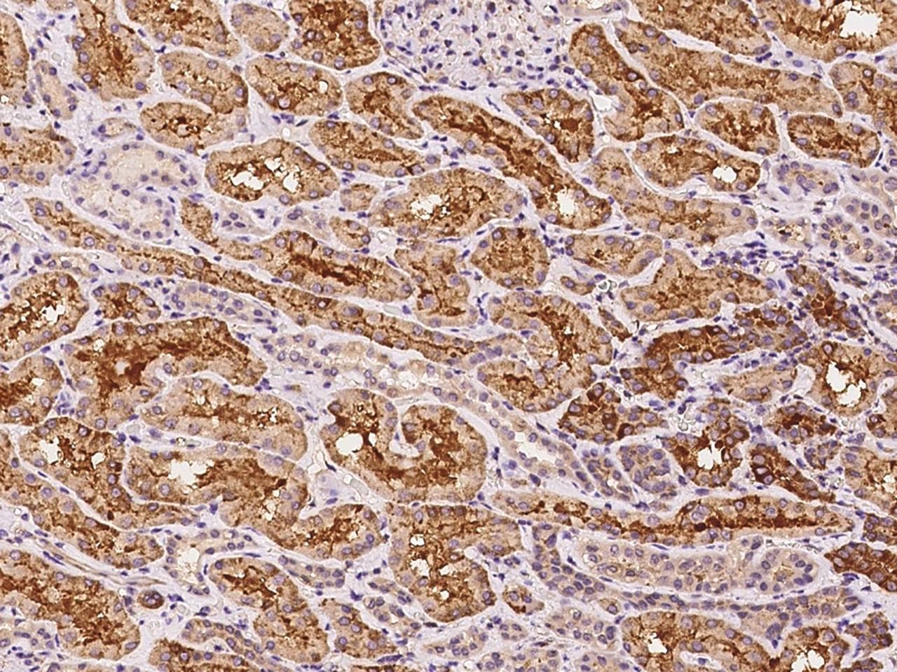 Polyclonal Rabbit anti-Human LY9 / CD229 Antibody (IHC, WB)