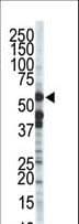 ZMPSTE24 Antibody (aa440-470)