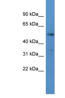CYP24 / CYP24A1 Antibody (aa420-469)