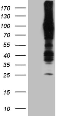 APBB1IP / RIAM Antibody (clone OTI1F2)