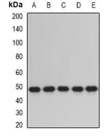 IHC-plus™ Polyclonal Rabbit anti-Human PDIA6 / ERP5 Antibody (IHC, IF, WB)