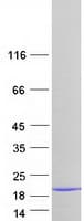 Human LSM3 Protein (Recombinant Myc-DDK (Flag))