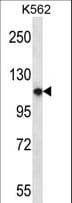 Polyclonal Rabbit anti-Human PLEKHM1 Antibody (aa50-78, WB)
