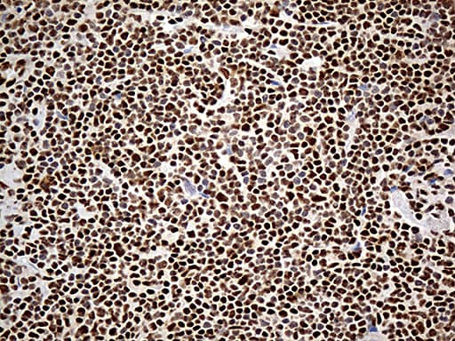 Monoclonal Mouse anti-Human DDX39B / UAP56 Antibody (clone OTI8B8, aa319-428, IHC, WB)