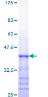 Human HFE Protein (Recombinant GST, N-terminus)
