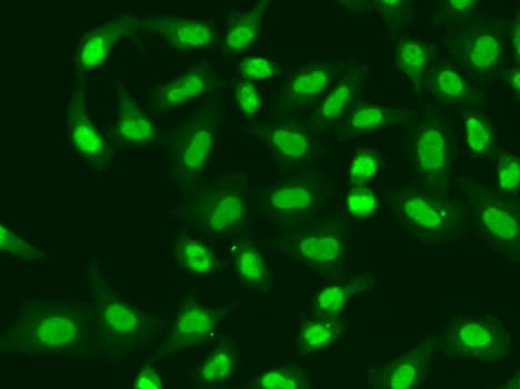Polyclonal Rabbit anti-Human Aprataxin / APTX Antibody (IHC, IF, WB)