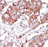 Polyclonal Rabbit anti-Human ALK3 / BMPR1A Antibody (aa166-195, IHC, WB)