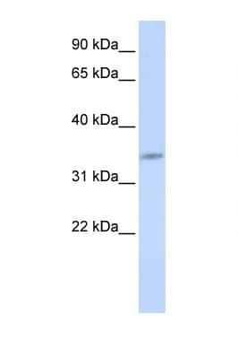 CDK5 Antibody (C-Terminus)