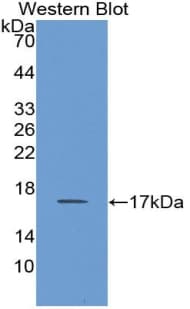 CD66d / CEACAM3 Antibody (aa273-416)
