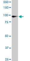 IHC-plus™ Monoclonal Mouse anti-Human UBTF / UBF Antibody (clone 2D8, IHC, IF, WB)