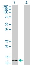 IHC-plus™ HBZ Antibody (clone 1G10)