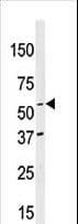 NAE1 / APPBP1 Antibody (aa430-459)