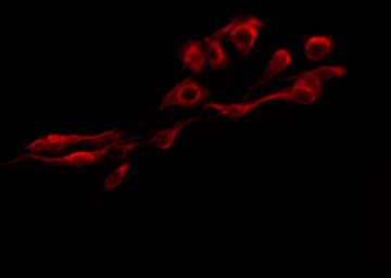 ITGB3 / Integrin Beta 3 / CD61 Antibody (phospho-Tyr785)