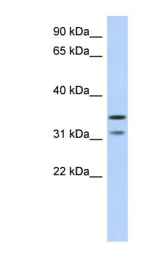 Polyclonal Rabbit anti-Human ELP5 Antibody (aa143-192, WB)