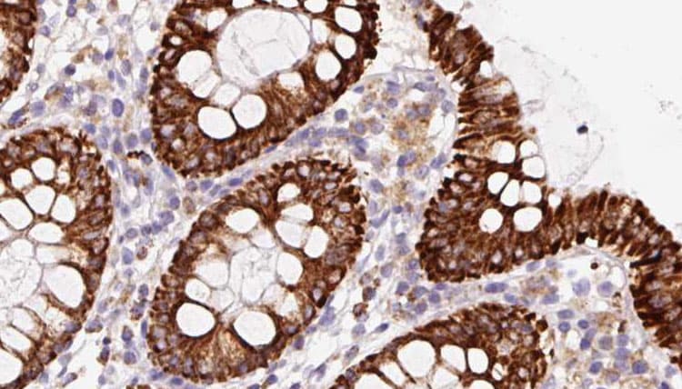 SCG10 / STMN2 Antibody