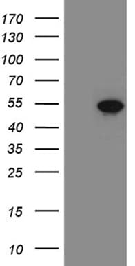 FOXP3 Antibody (clone OTI3H2)