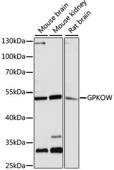 Polyclonal Rabbit anti-Human GPKOW Antibody (IHC, WB)