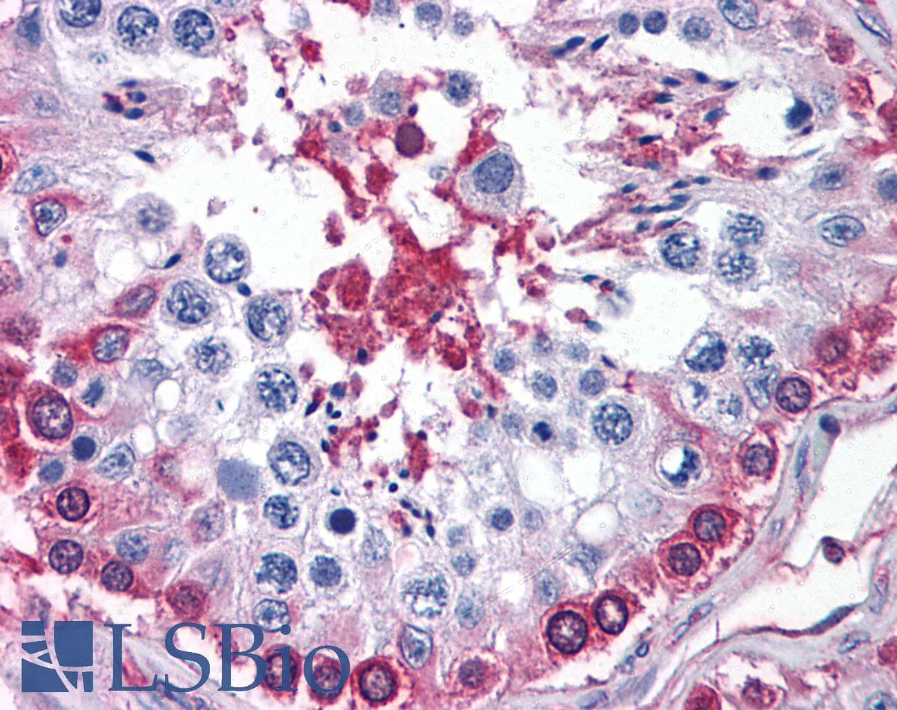 IHC-plus™ GPI Antibody (aa56-67)