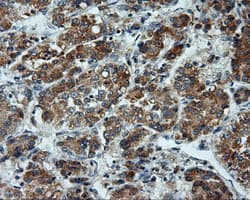 LIPG / Endothelial Lipase Antibody (clone OTI2E12, Carrier-free)