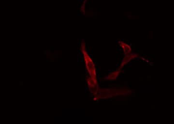 Polyclonal Rabbit anti-Human COL2A1 / Collagen II Alpha 1 Antibody (IHC, IF, WB)