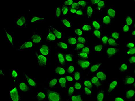 Polyclonal Rabbit anti-Human DNMT / DNMT1 Antibody (IHC, IF, WB)