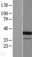 CCDC84 Protein (Over-Expression Lysate Myc-DDK (Flag))