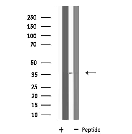 Polyclonal Rabbit anti-Human LRG1 / LRG Antibody (IF, WB)