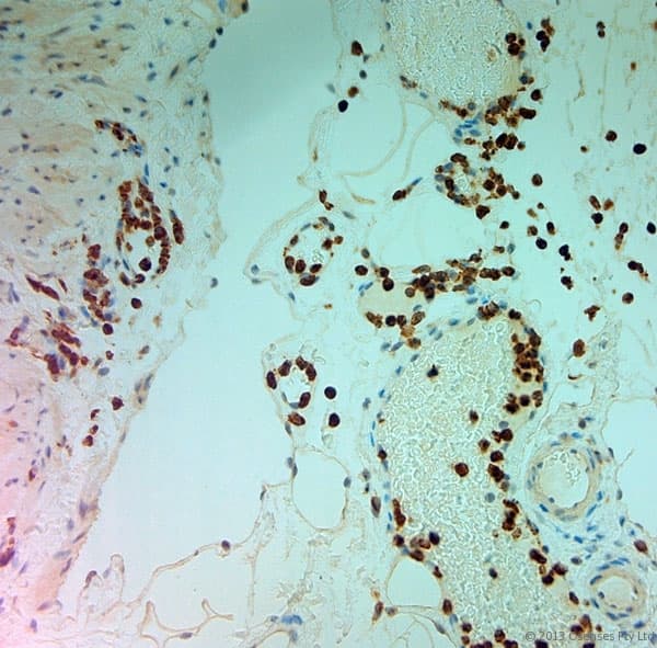 MPO / Myeloperoxidase Antibody
