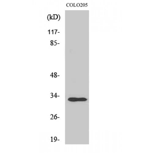 RNF144A / RNF144 Antibody (120-200 aa, Internal)