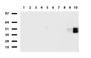 Monoclonal Mouse anti-Human FCGR1A / CD64 Antibody (clone UMAB74, IHC, WB)