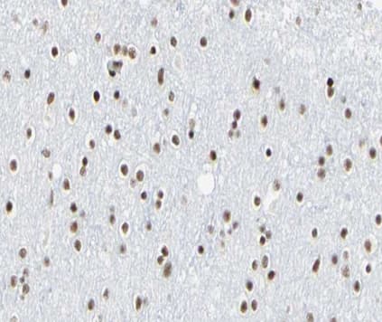 Polyclonal Rabbit anti-Human E2F6 Antibody (IHC, IF, WB)