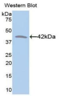CKM / Creatine Kinase MM Antibody (aa11-367)