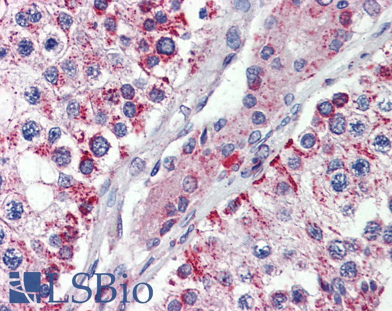 IHC-plus™ NIPSNAP3A Antibody