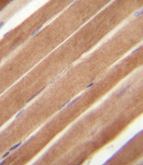 EPHB2 / EPH Receptor B2 Antibody (aa103-133)
