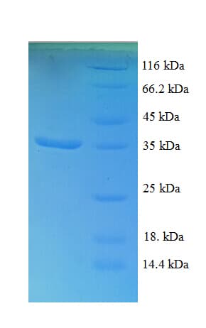 Human EEF1D Protein (Recombinant His)