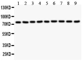 JUP/CTNNG/Junction Plakoglobin Antibody (aa556-745)