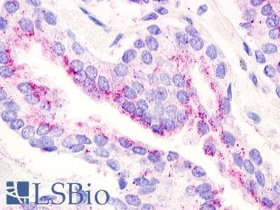 PathPlus™ Polyclonal Rabbit anti-Human GPR21 Antibody (Transmembrane Domain, IHC)