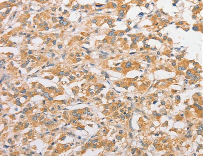 TLR5 Antibody
