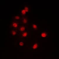 EFTUD2 Antibody (Internal)