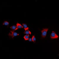 ERBB3 / HER3 Antibody (N-Terminus)