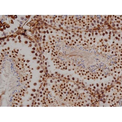 MAPT / Tau Antibody (phospho-Ser396)
