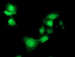 SHPK / CARKL Antibody (clone OTI4E9, Carrier-free)